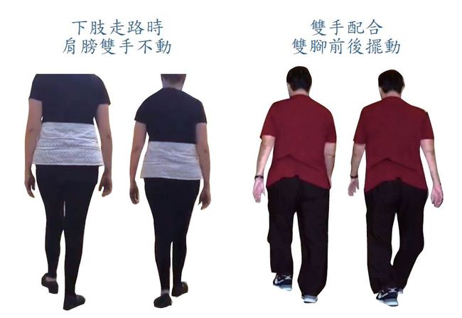膝蓋痛的步態