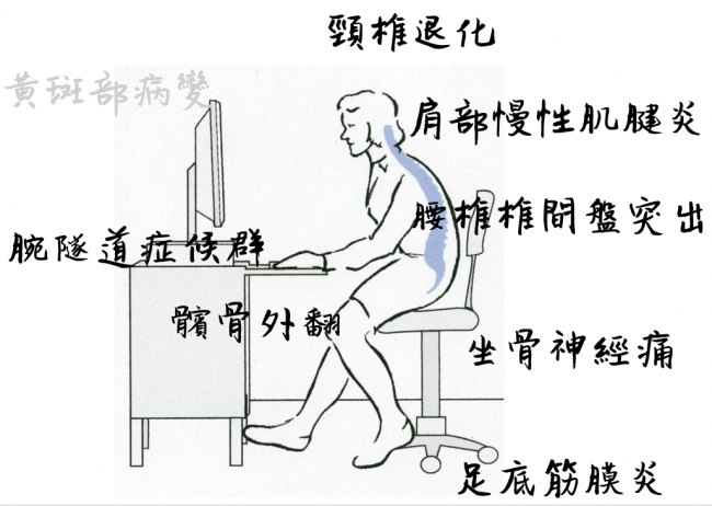 久坐問題