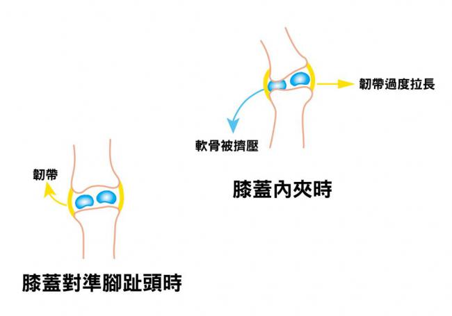 膝蓋內夾跟膝蓋對準腳趾頭