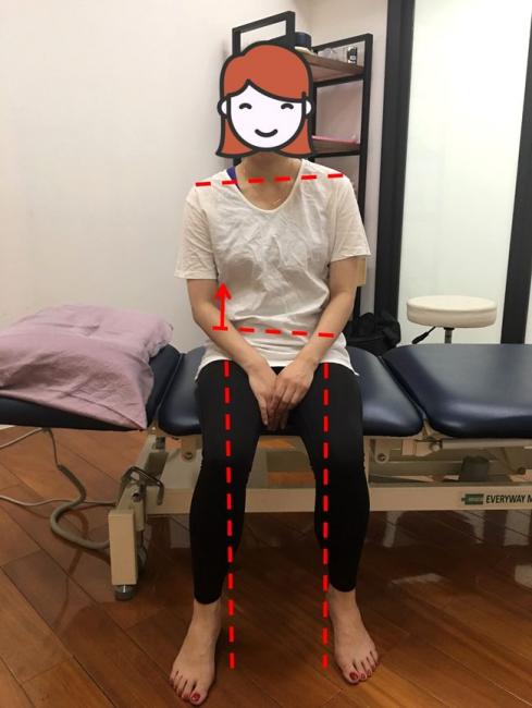 右肩低右邊骨盆高右膝向內偏