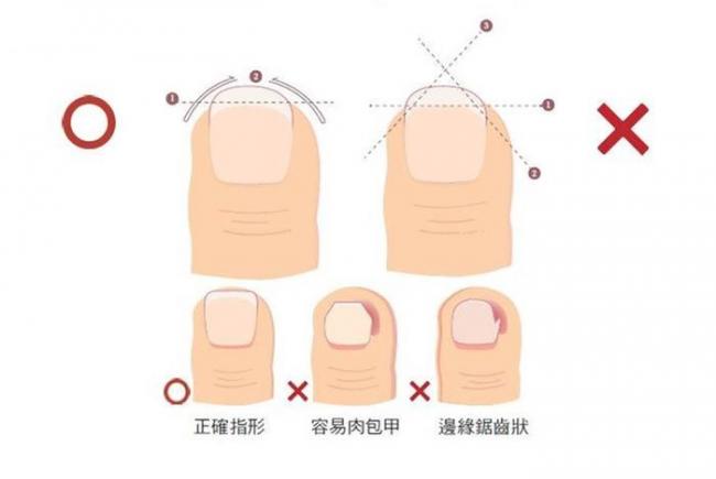 修剪指甲的正確方式
