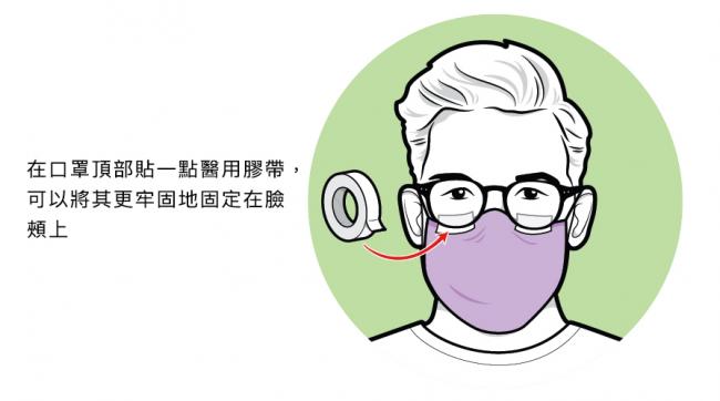 改善口罩貼合度的方法2：透氣膠帶