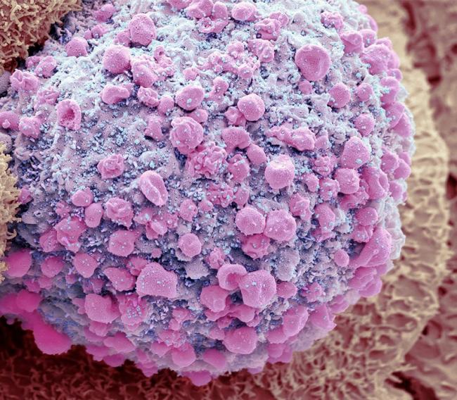 SARS-CoV-2 顆粒（藍色；人工著色）正從垂死的腸細胞中萌芽 