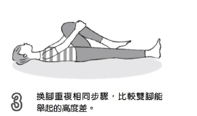 退化性髖關節炎