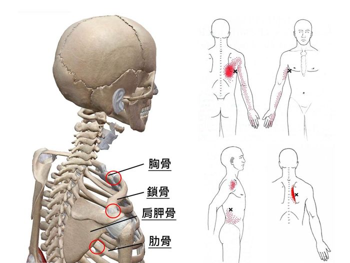 肩頸緊繃痠痛、動作卡卡元凶是肩膀下沉！  3 招處理過度緊縮的肌肉